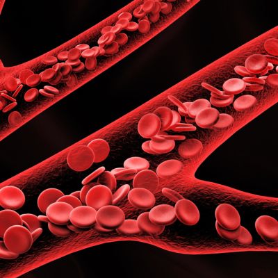 Vascular Trauma and Emergency Care
